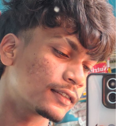 Dhiraj kumar