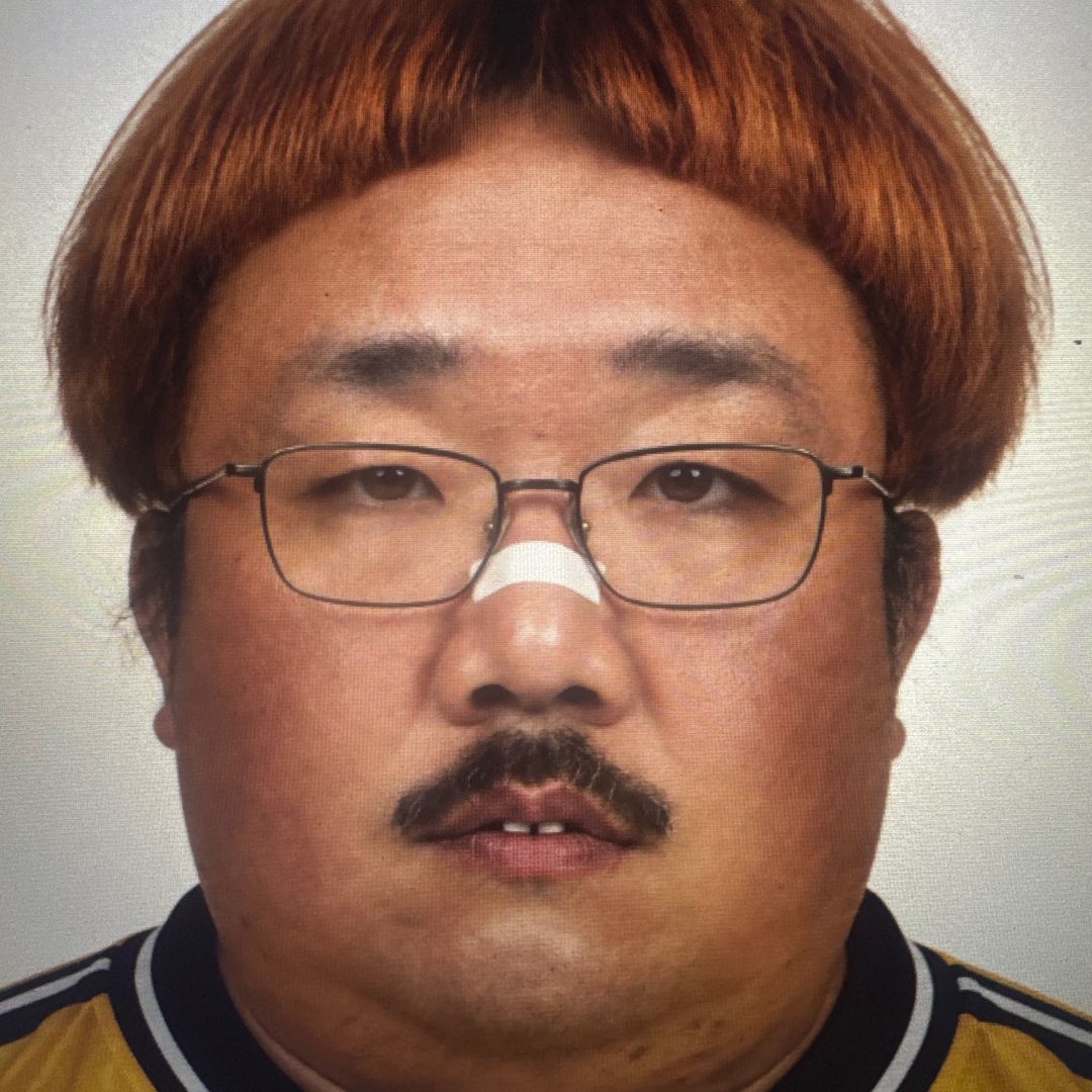 Chin