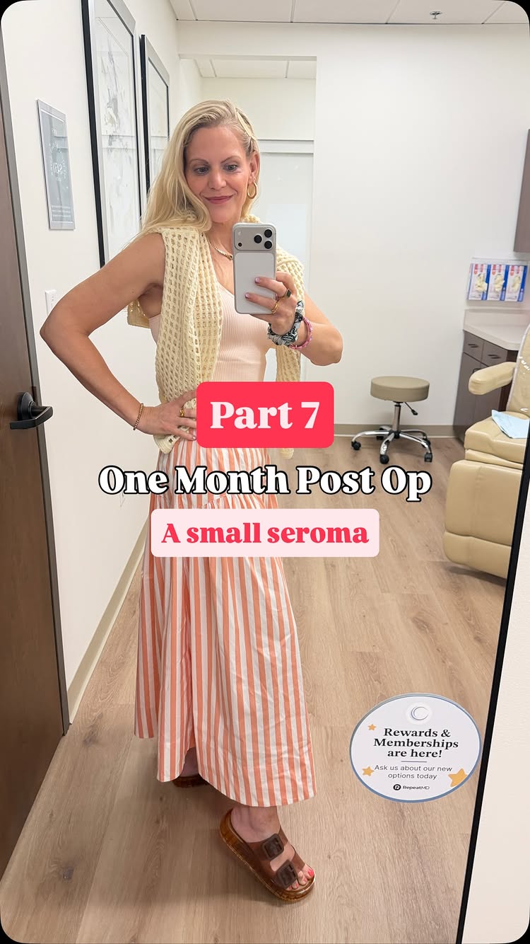 ⚠️ Content Warning: This video contains brief footage of a minor medical procedure (seroma drainage). One month post-...