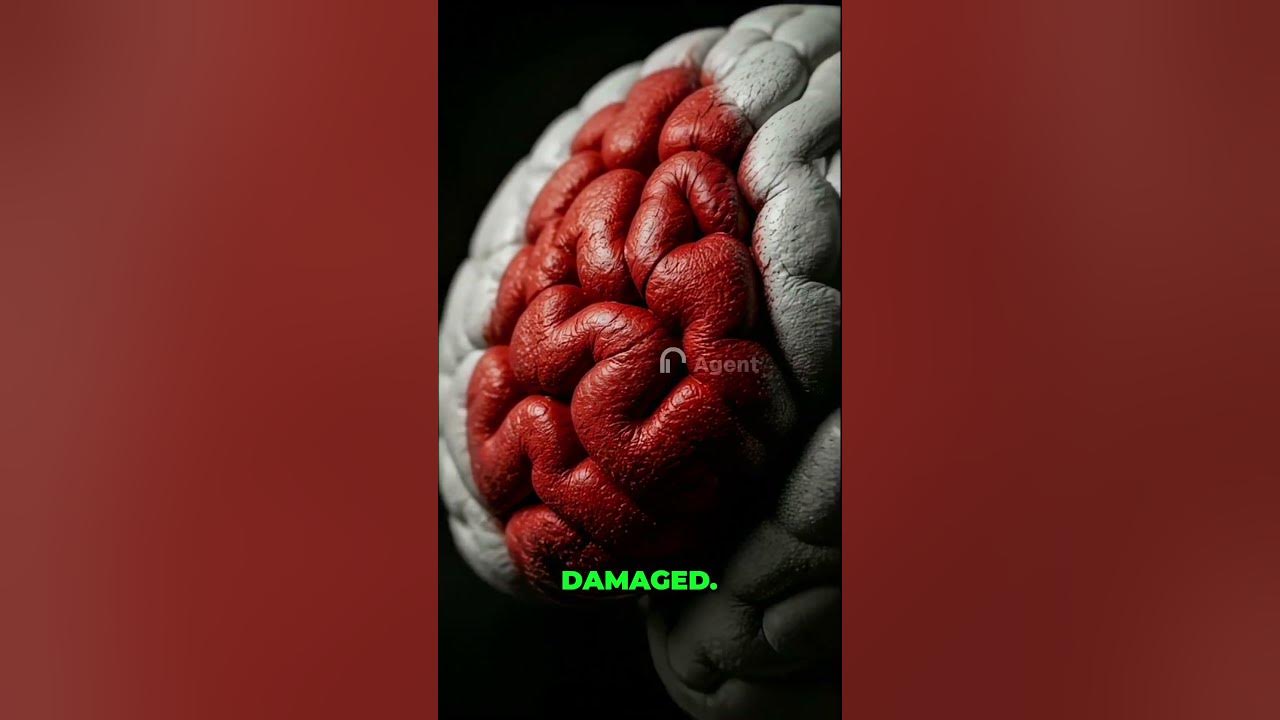 Willpower won't fix addiction #shorts #addiction #mindset darkpsychology,deepquotes,psychologyshorts,traumahealing,su...