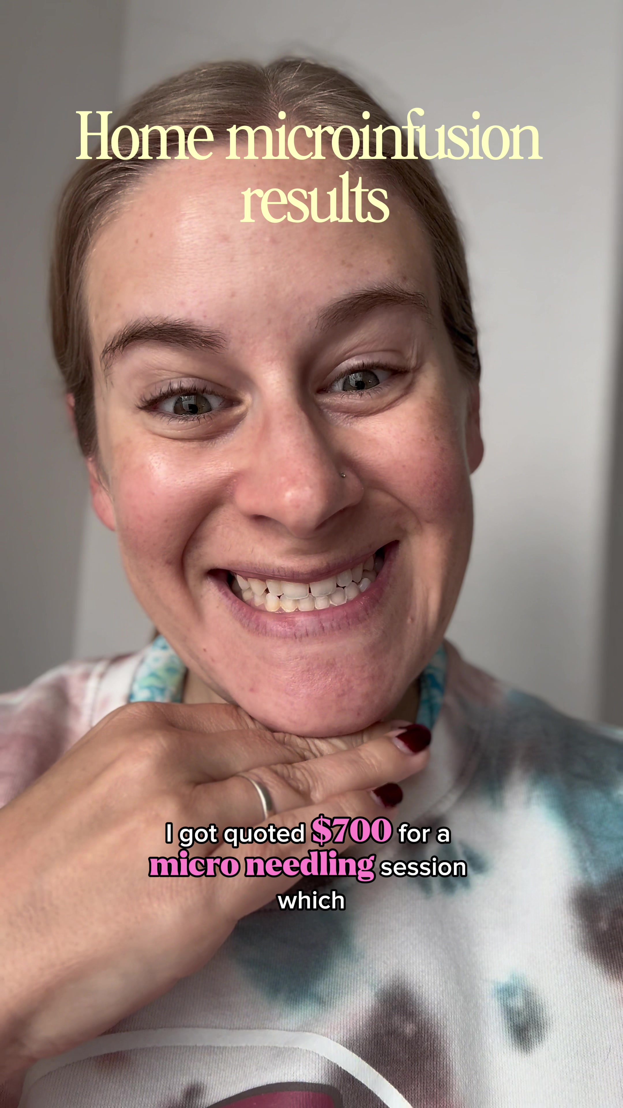 Home micro infusion results with @Qure Skincare micro infusion system. If you’ve been scared to try micro needling an...