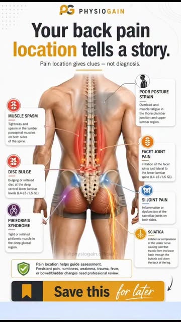 Your back pain is not always random. Where it hurts can give useful clues. 👇 ⚠️ Pain markings may slightly vary pers...