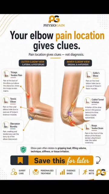 ⚠️ Visual markings may be slightly approximate for education, so please read the full caption first. Pain location gi...