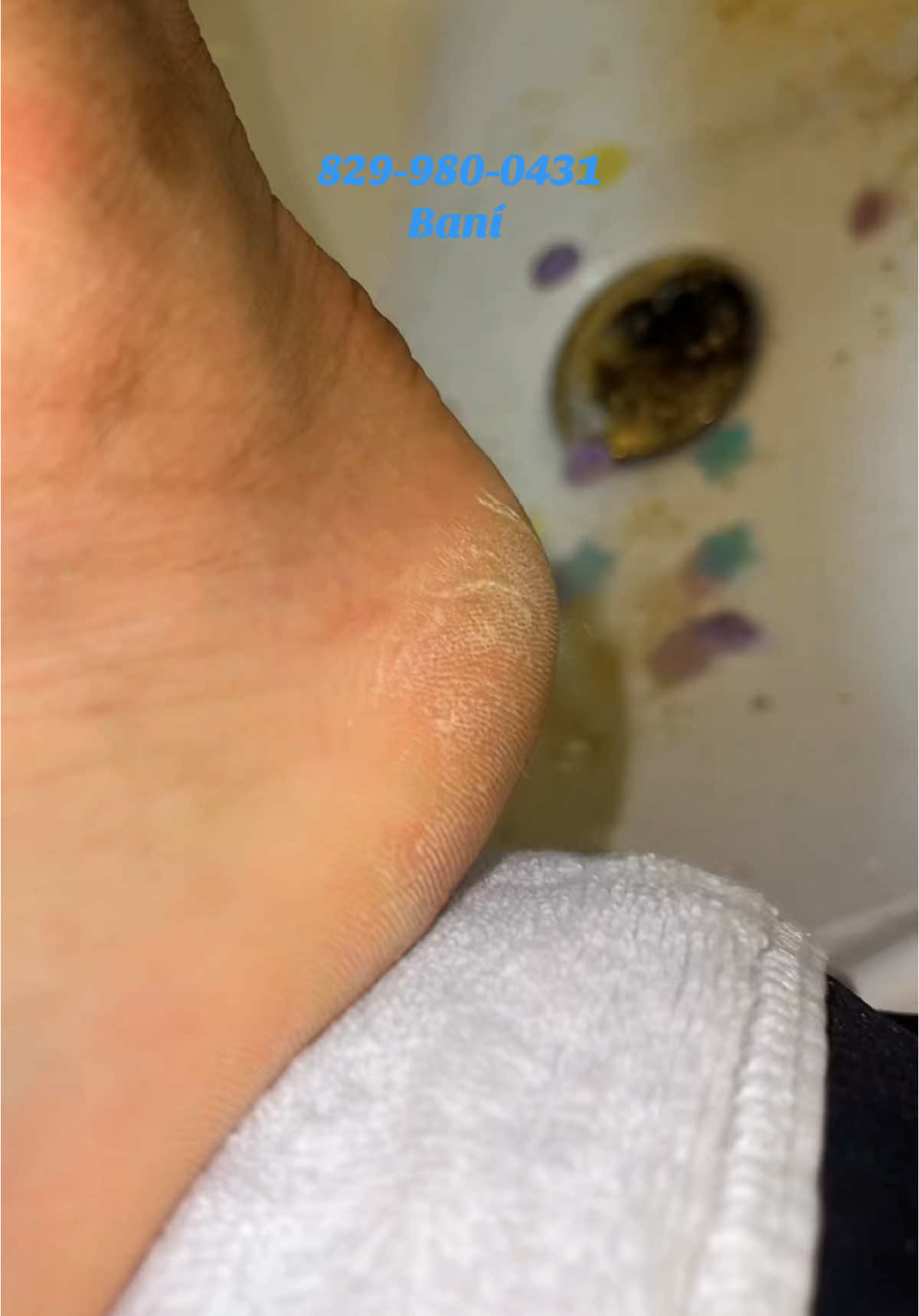 Acompáñame a ver esta magia en los pies 🦶 @Diosa #pedispa #pies #agrietado #resequedad #spa #emprendimiento #sigueme...