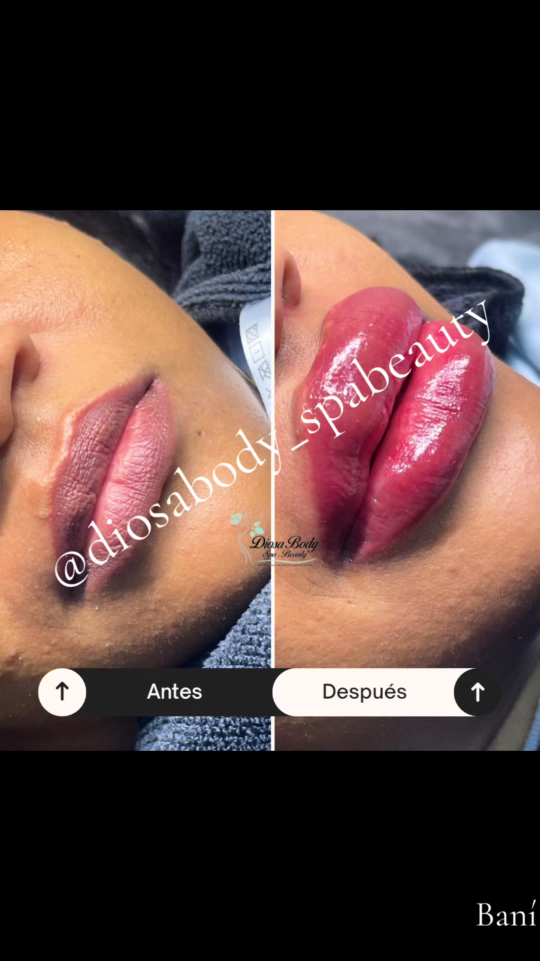 Micropigmentacion de labios y pura hermoshuraa 🥺😍 #micropigmentacion #diorky19 #sigueme❤️ #cambio #videoviral