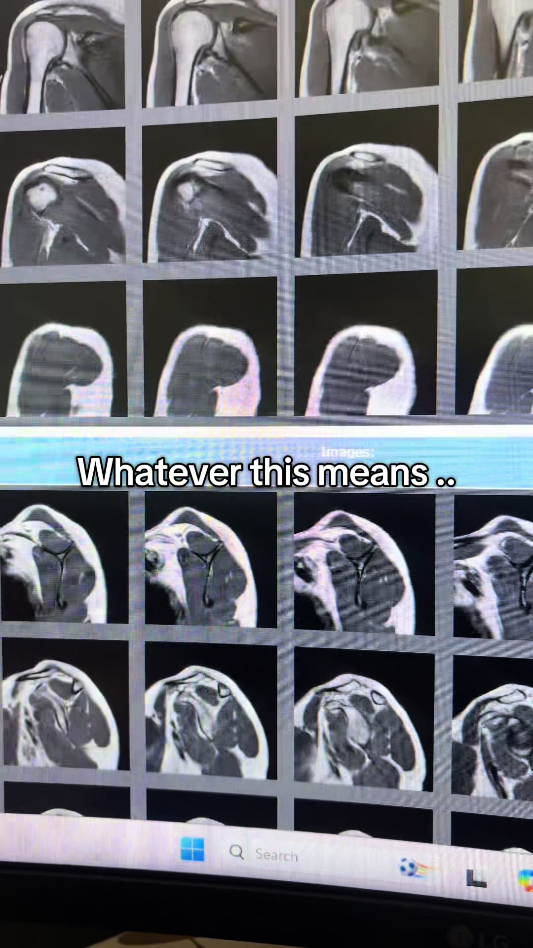 Can’t wait for my Evidence Based Healing concept 💗✨🧬 But this lesson is… Don’t cross midline guys 😭. #bcbasoftikto...