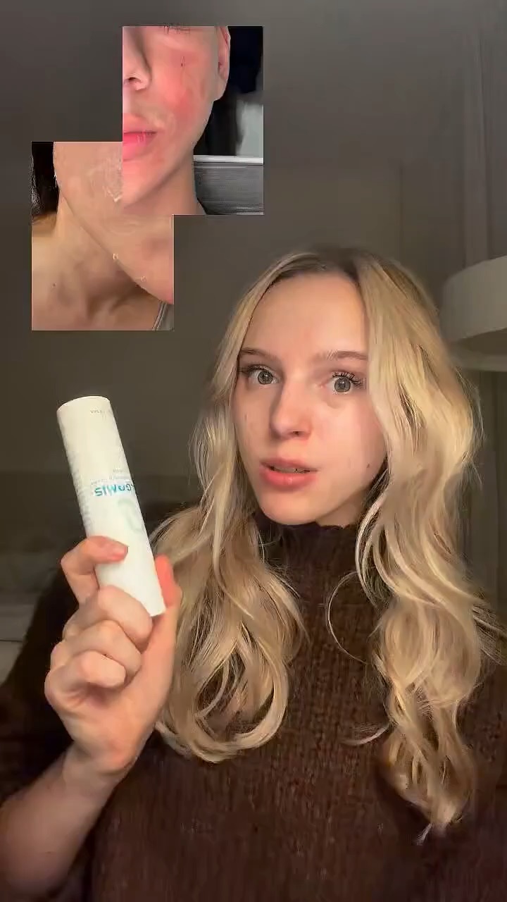 Tretinoin Tutorial