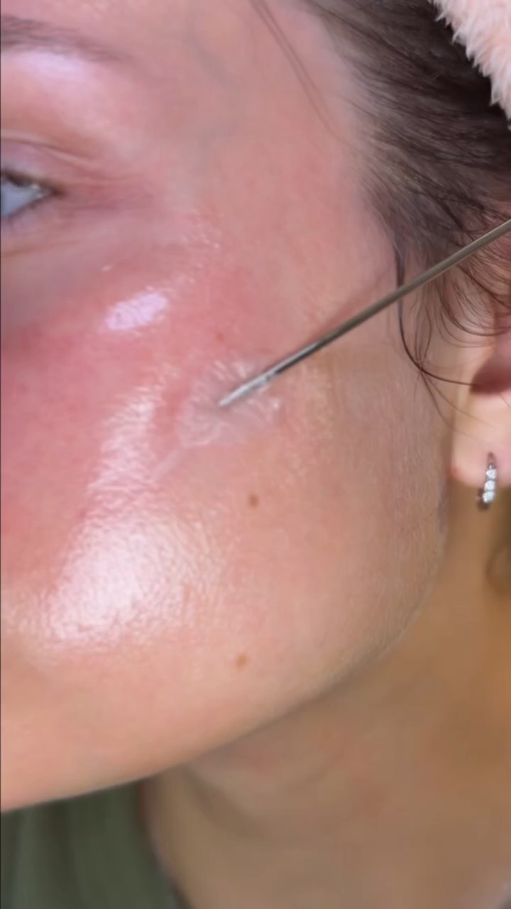 skin closeup