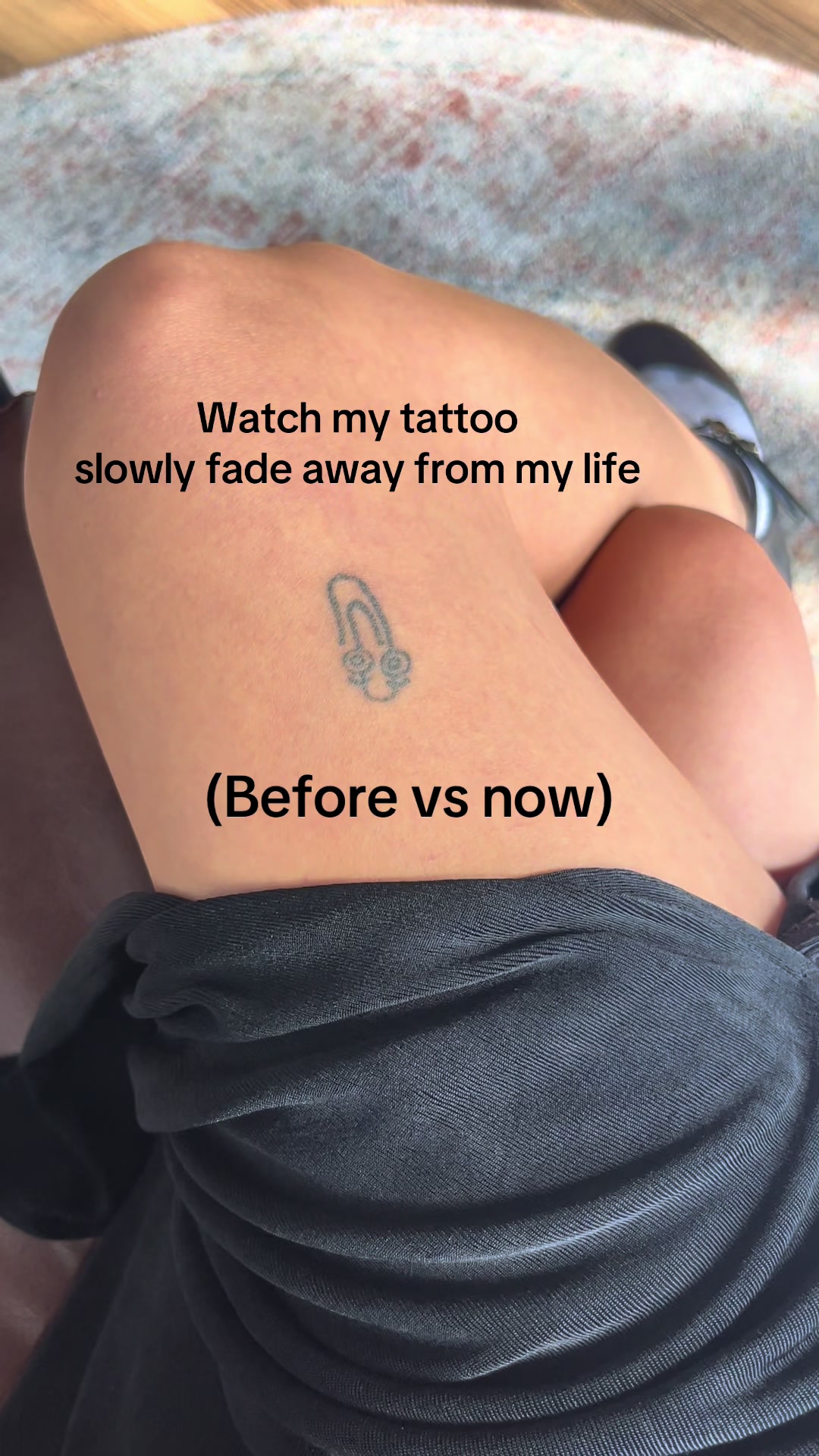 Take this as your sign to get your tattoo removed! I didn’t believe tattoo removal would work until I met @Removery L...