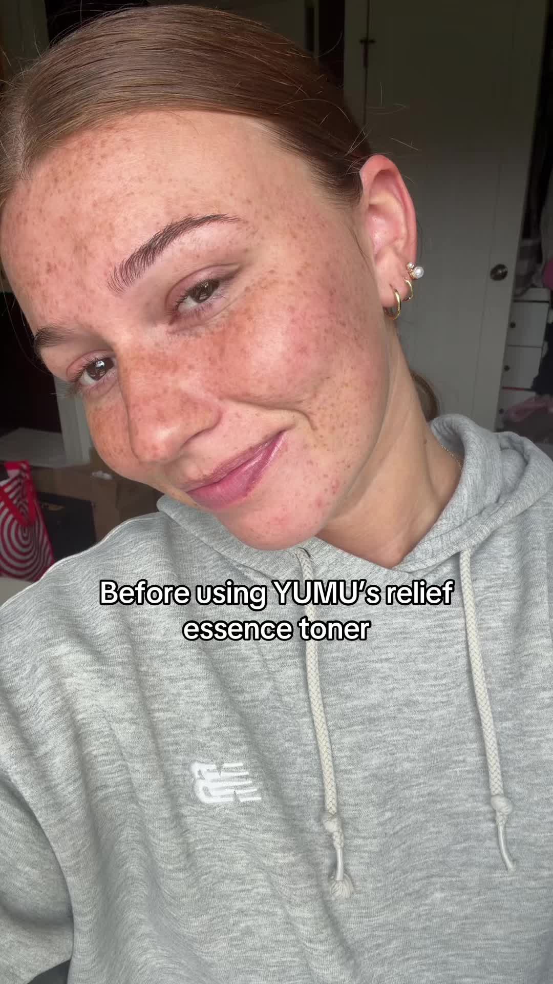 #evenskin #niacinamide #yumu Niacinamide- Helps improve uneven skin tone. AHA + LHA + PHA- Gently exfoliate to remove...