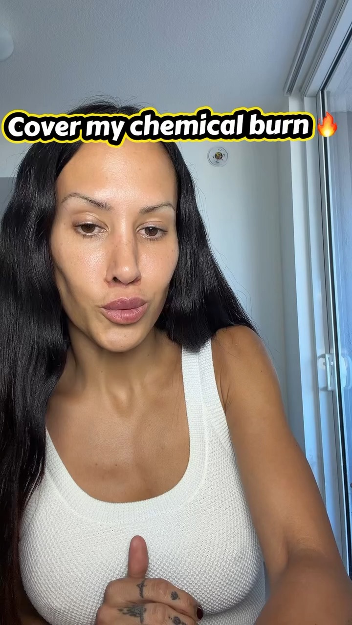 Make up covering up a chemical peel