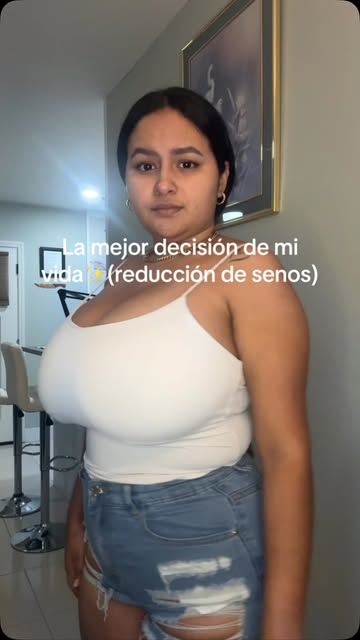 La mejor decisión ❤️ si hay alguna chica que lo necesita mi recomendación es,siiii hazlo sin pensarlo#viral #breastre...