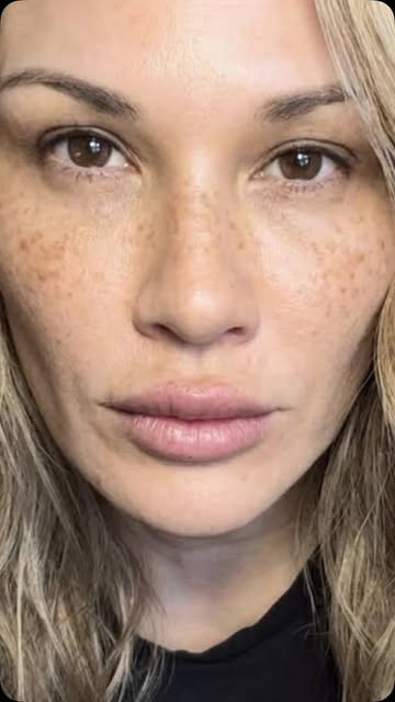 Manchas de sol? No gracias! https://amzn.to/4r4LyYG #skincare #koreanskincare #drmelaxin @dr.melaxin_global