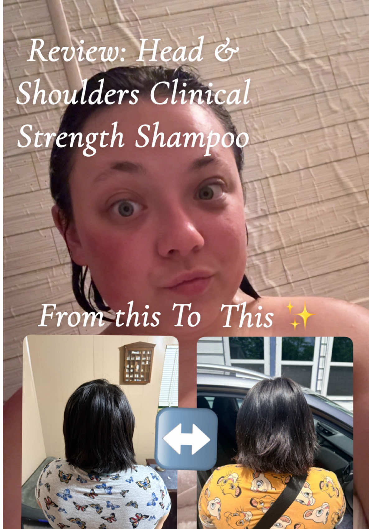 No flakes, no itch, just clean soft hair! I’m literally obsessed! It’s the perfect shampoo to use especially after th...