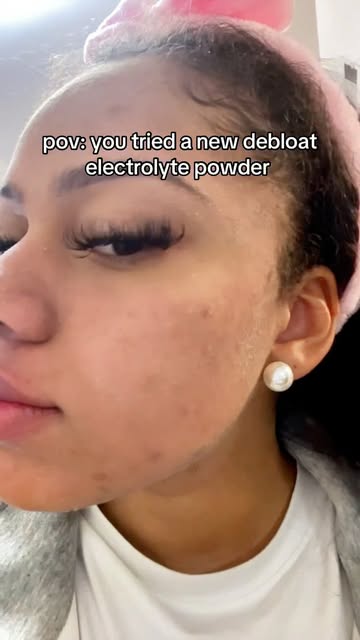 pov: you tried a new debloat electrolyte powder ✨ #skinsalt #SkinSalt #eletrolytes #debloat #skintok