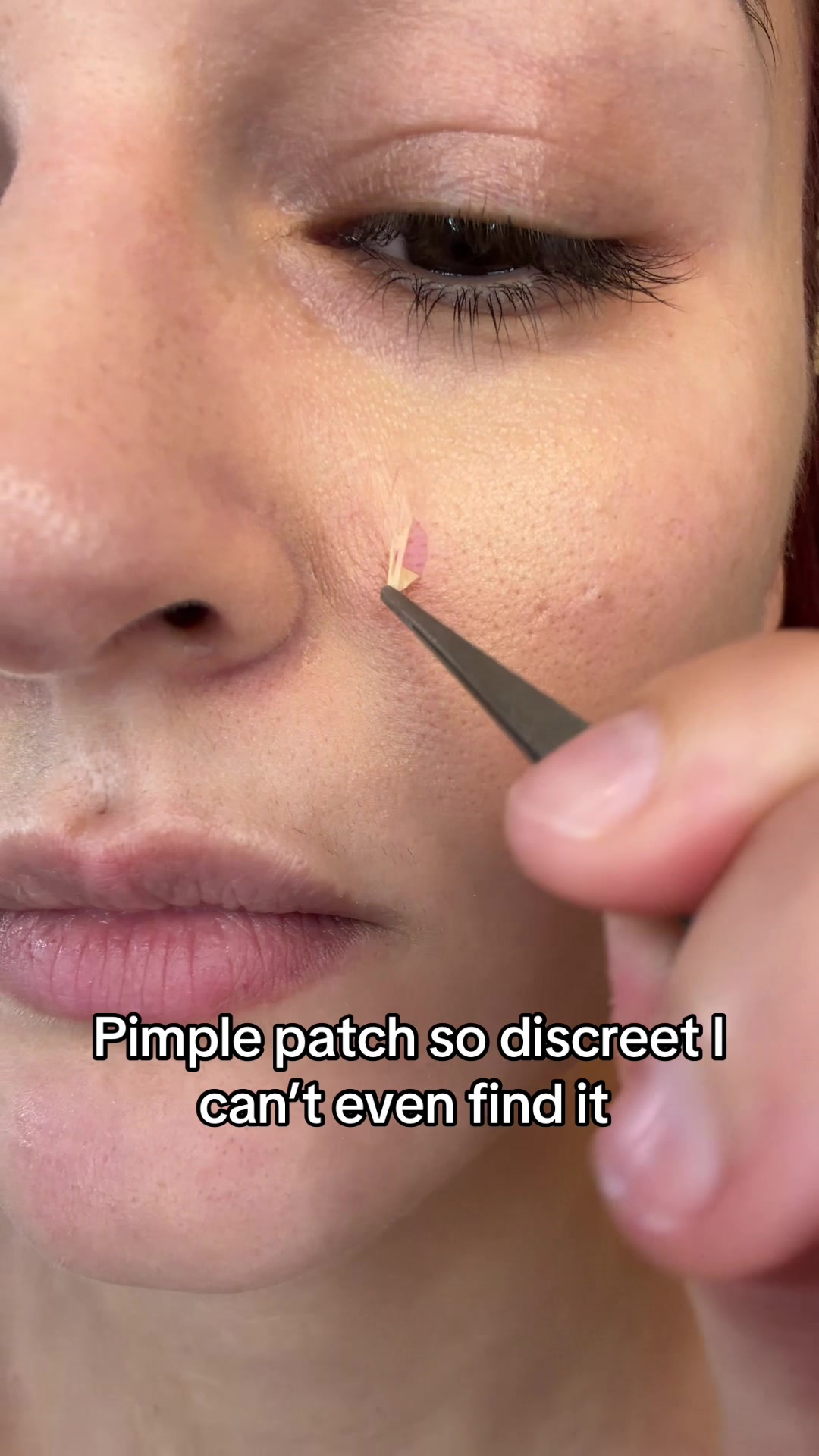 @Dr.Melaxin these patches are so thin I can’t even find them under my makeup 🤨 def not medical advice but these prot...