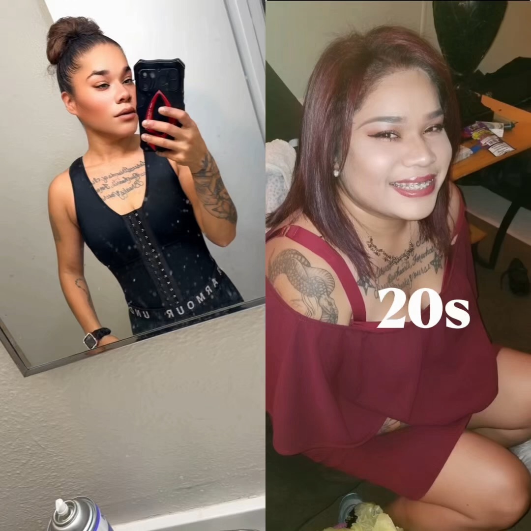 Weight loss