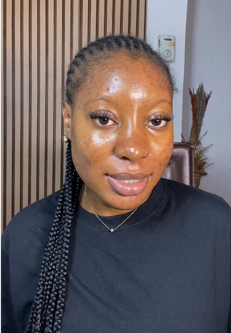 Tretinoin is powerful… but it’s not a one-man army. Dark spots need support ingredients to truly fade. Layer smart. B...