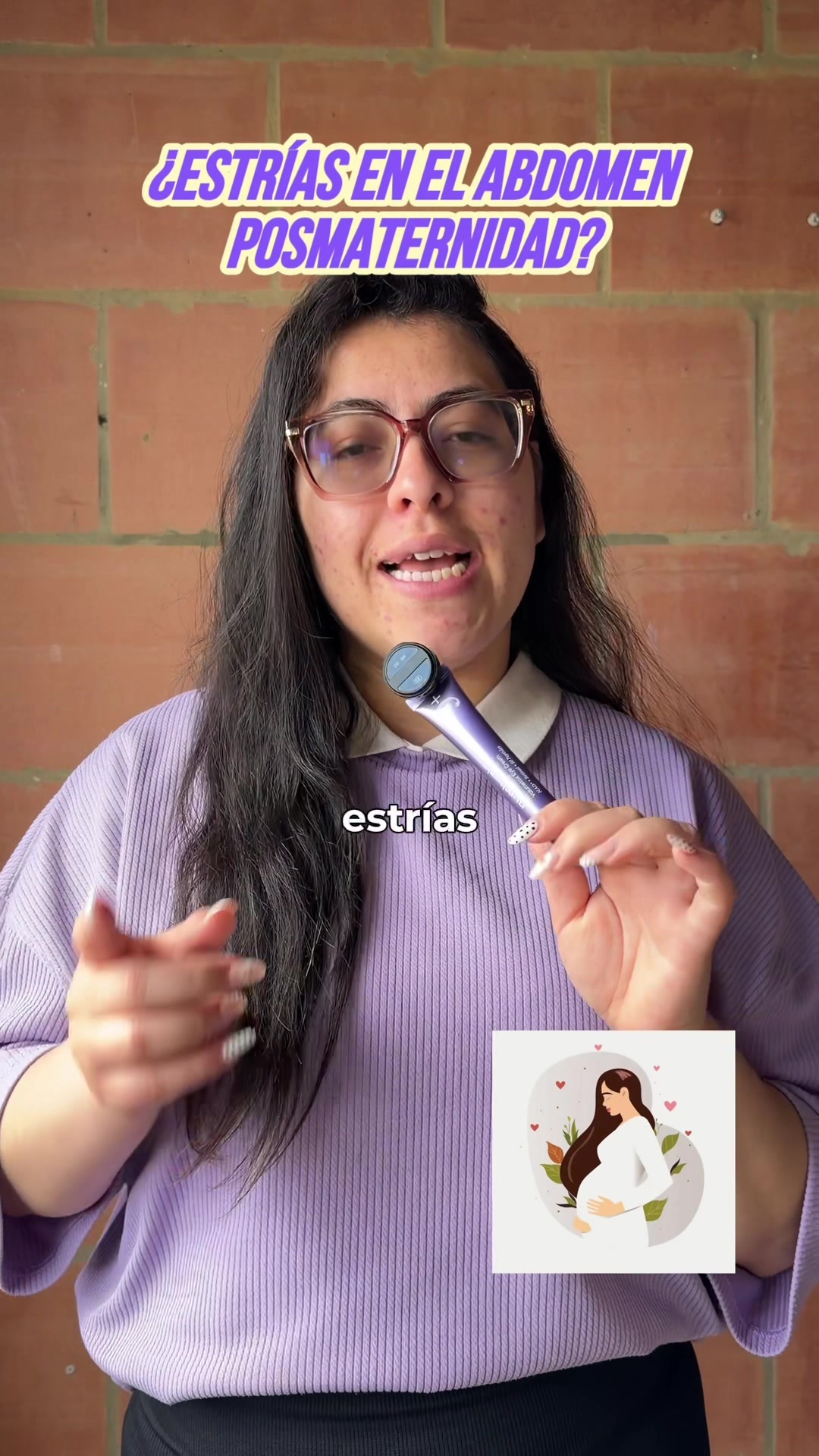 ¡Acompañame a probar esto! 💜 Sí o sí tenemos que hablar de las estrías en el abdomen y ombligo después de la materni...