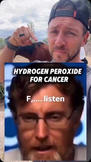Do you use peroxide?