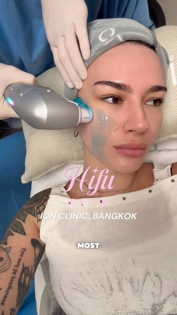the non-surgical face snatch, done on my lunch break. clinic’s tagged below 👇🏻 Thanks to @ionclinic.bkk 🤍 #hifu #h...