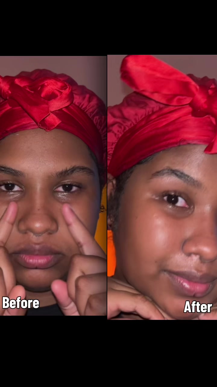 NO BOTOX & FILLER @numbuzin #numbuzinRetiNADChallenge #numbuzin #retinal #nad 9💜