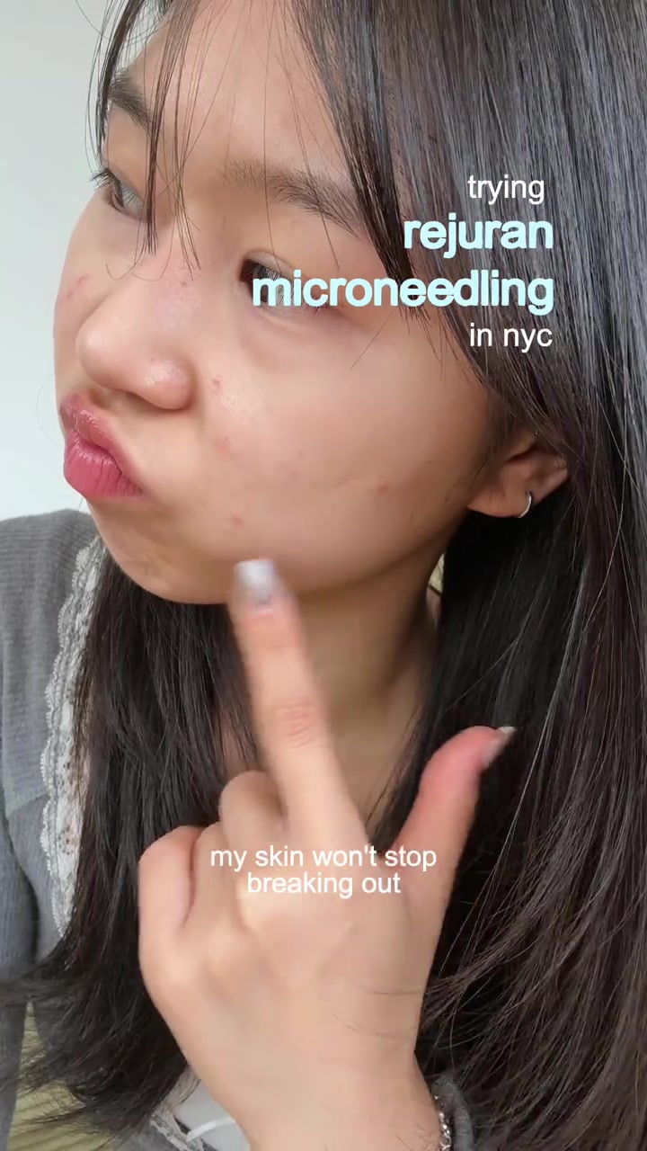 #skin