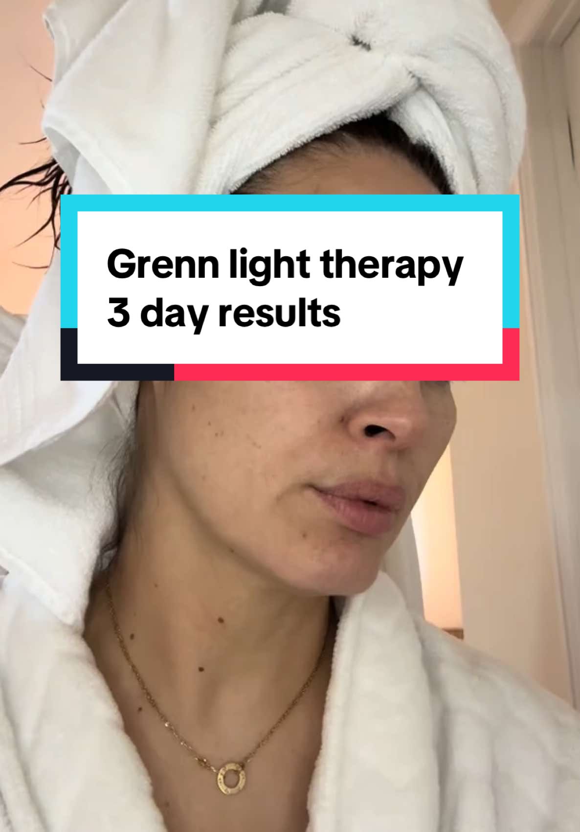 I’ve done this video before and for some reason people don’t believe how fast green light works. What I typically do...