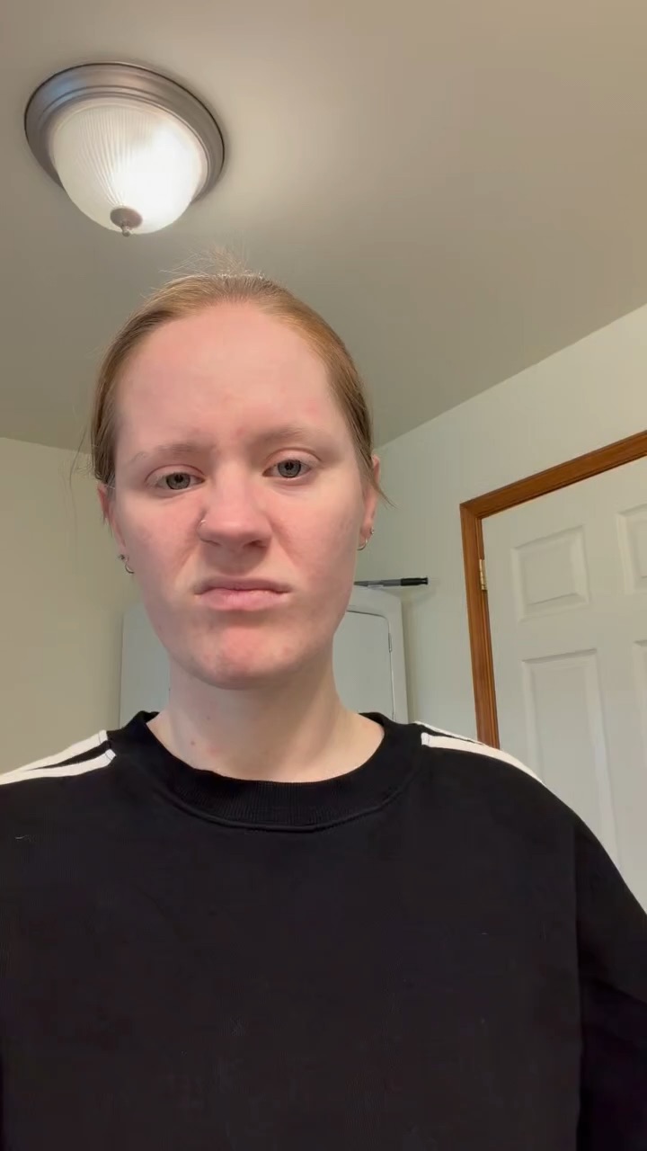 Niacinamide + Zinc Serum