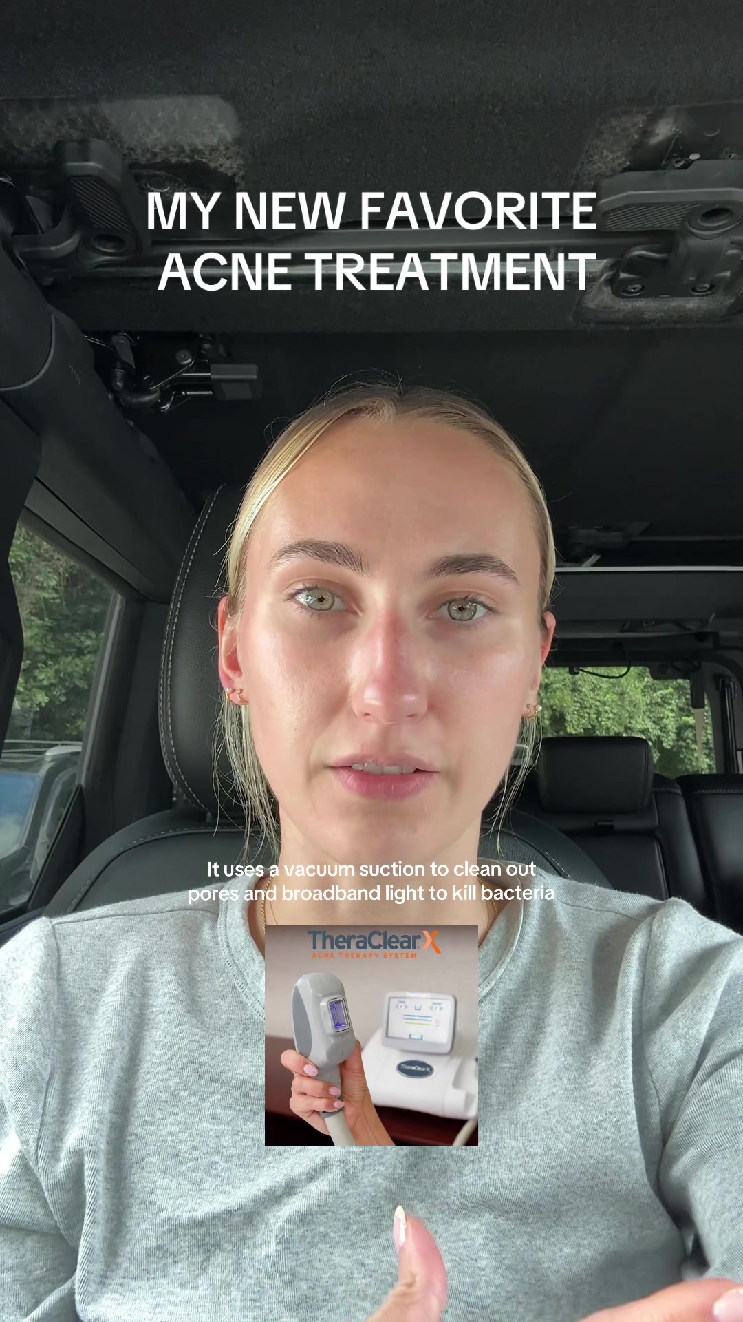 #acne