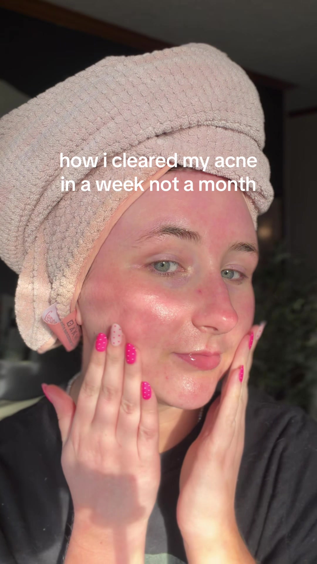 all u neeeed!!✨ #skincare #skintok #glowuptips #clearskin #skinhacks
