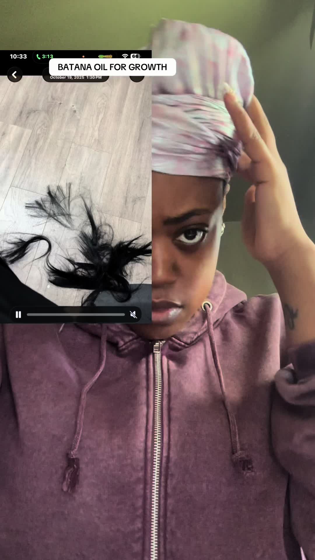 #fyp #hairgrowth #viral