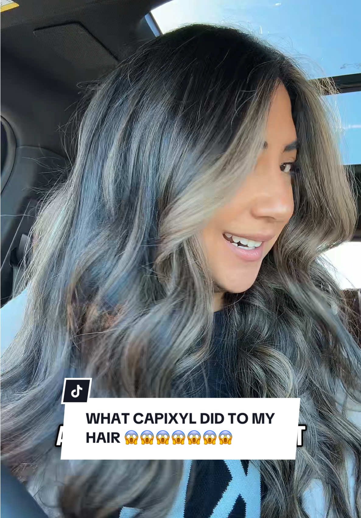 WHY CAPIYXL ⬇️⬇️⬇️ Capixyl targets multiple causes of hair loss by: ✔ Blocking the effects of DHT on hair follicles ✔...