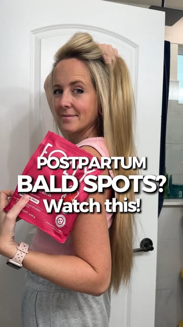 Those postpartum temple spots have been hanging around for YEARS. 😅 So when I started taking Folly Hair Health Gummi...